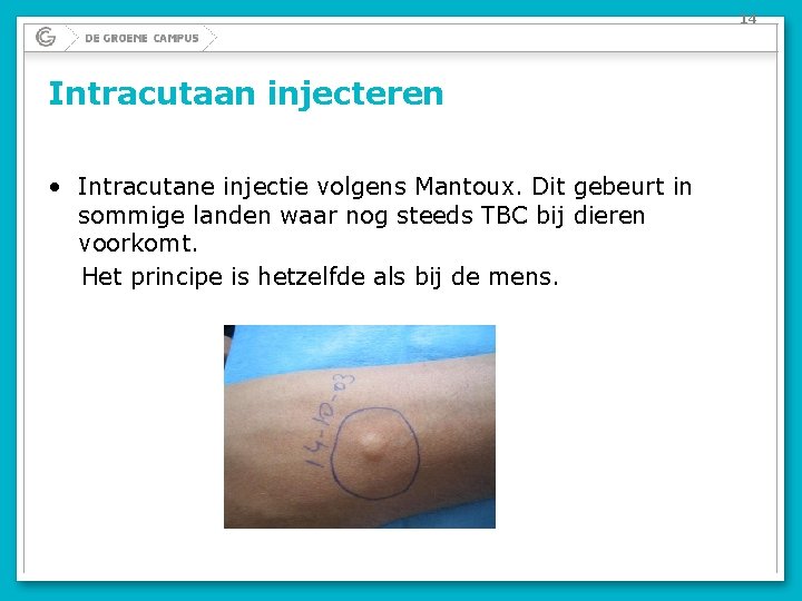 14 Intracutaan injecteren • Intracutane injectie volgens Mantoux. Dit gebeurt in sommige landen waar