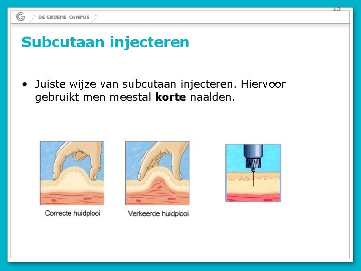 15 Subcutaan injecteren • Juiste wijze van subcutaan injecteren. Hiervoor gebruikt men meestal korte