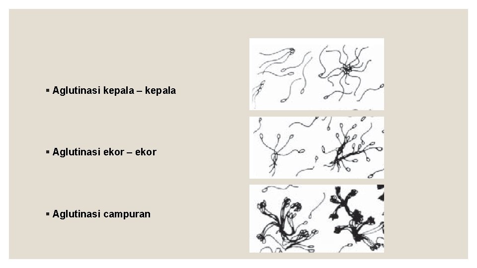 § Aglutinasi kepala – kepala § Aglutinasi ekor – ekor § Aglutinasi campuran 