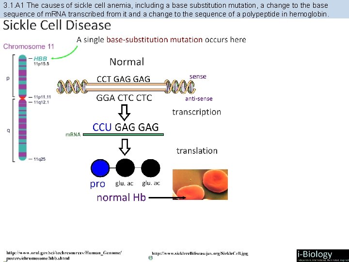 3. 1. A 1 The causes of sickle cell anemia, including a base substitution