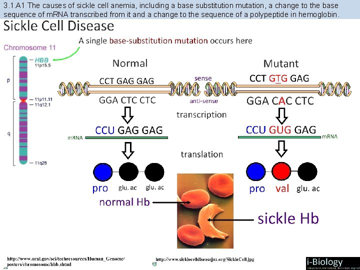 3. 1. A 1 The causes of sickle cell anemia, including a base substitution