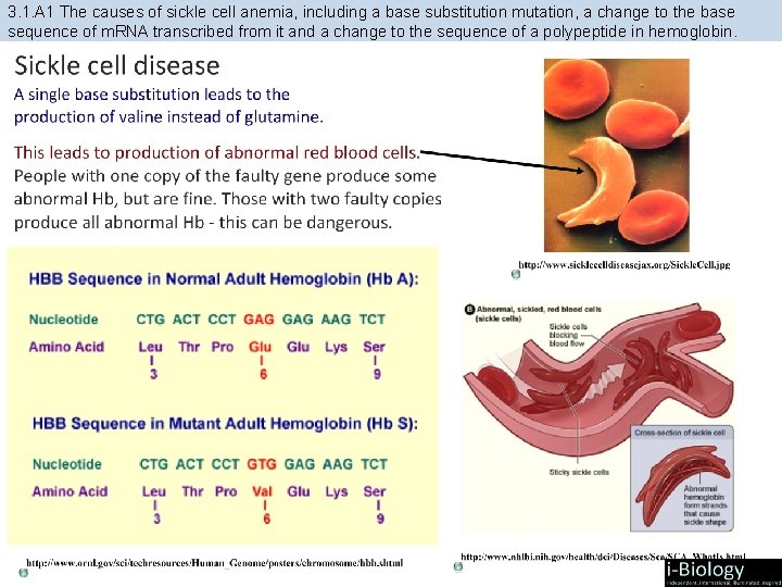3. 1. A 1 The causes of sickle cell anemia, including a base substitution