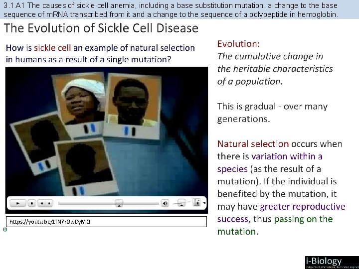 3. 1. A 1 The causes of sickle cell anemia, including a base substitution