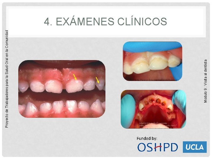 Modulo 9 : Visita al dentista Proyecto de Trabajadores para la Salud Oral en
