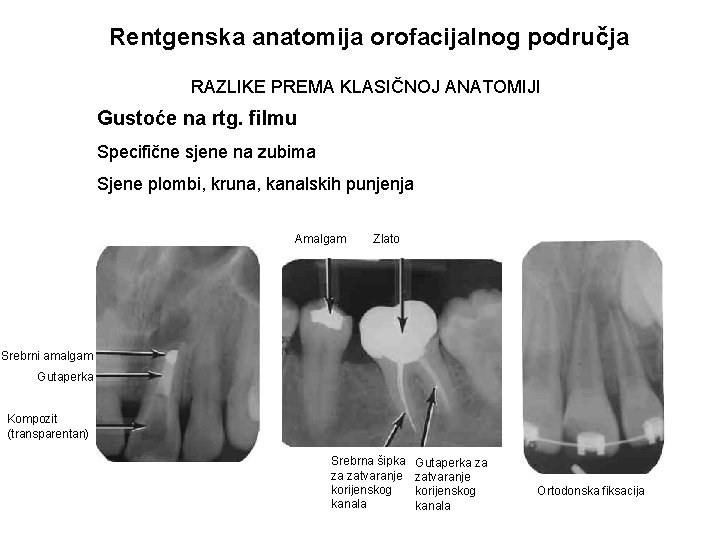 Rentgenska anatomija orofacijalnog područja RAZLIKE PREMA KLASIČNOJ ANATOMIJI Gustoće na rtg. filmu Specifične sjene