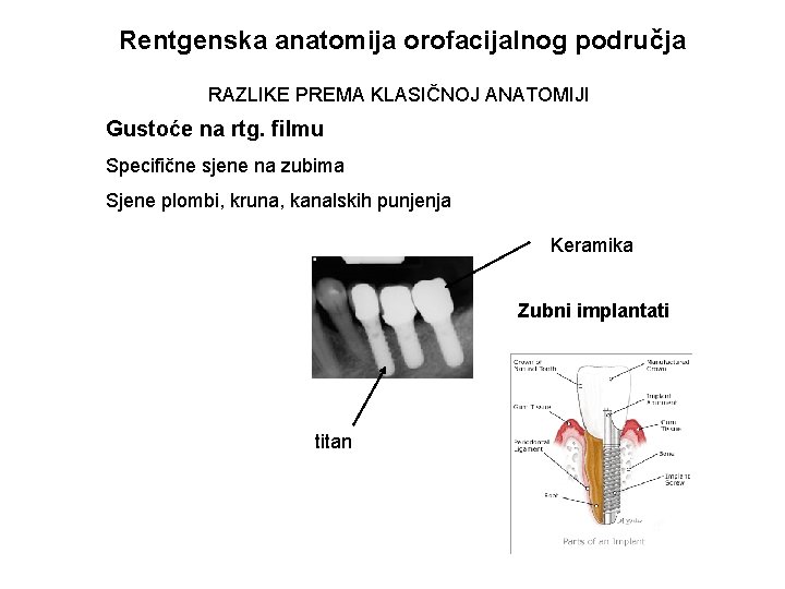 Rentgenska anatomija orofacijalnog područja RAZLIKE PREMA KLASIČNOJ ANATOMIJI Gustoće na rtg. filmu Specifične sjene