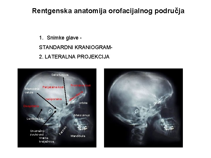 Rentgenska anatomija orofacijalnog područja 1. Snimke glave STANDARDNI KRANIOGRAM 2. LATERALNA PROJEKCIJA Sella turcica