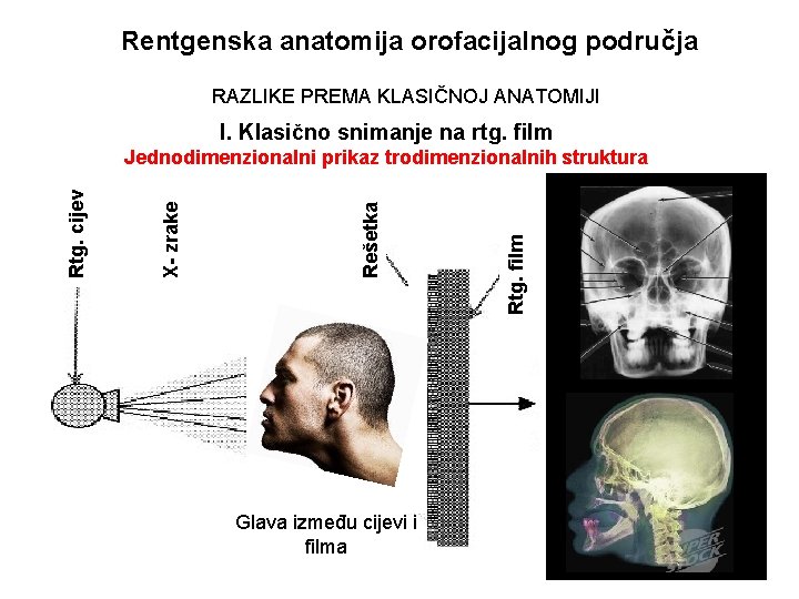 Rentgenska anatomija orofacijalnog područja RAZLIKE PREMA KLASIČNOJ ANATOMIJI I. Klasično snimanje na rtg. film