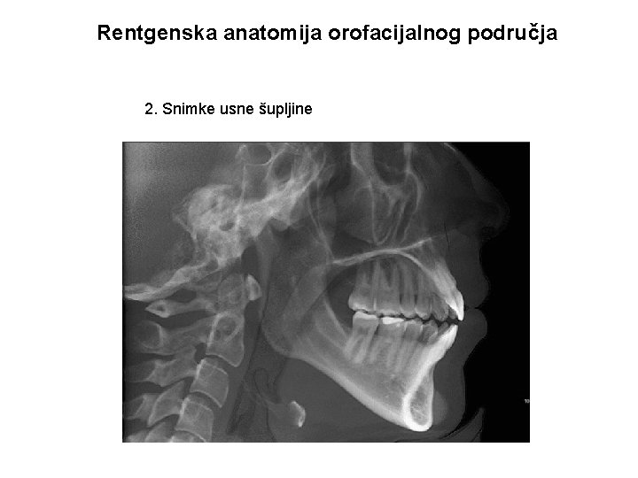 Rentgenska anatomija orofacijalnog područja 2. Snimke usne šupljine 