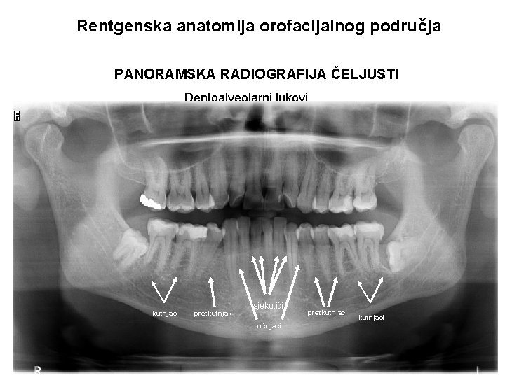 Rentgenska anatomija orofacijalnog područja PANORAMSKA RADIOGRAFIJA ČELJUSTI Dentoalveolarni lukovi kutnjaci pretkutnjak sjekutići očnjaci pretkutnjaci