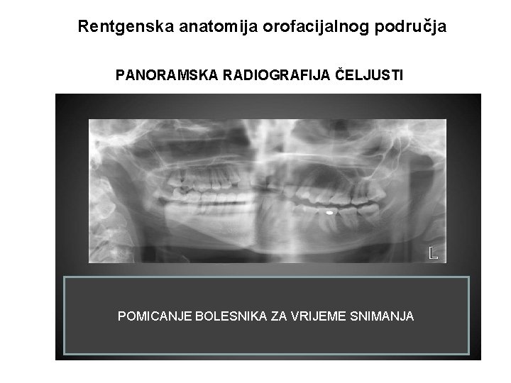 Rentgenska anatomija orofacijalnog područja PANORAMSKA RADIOGRAFIJA ČELJUSTI POMICANJE BOLESNIKA ZA VRIJEME SNIMANJA 