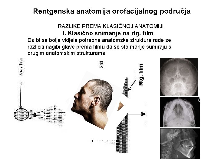 Rentgenska anatomija orofacijalnog područja RAZLIKE PREMA KLASIČNOJ ANATOMIJI I. Klasično snimanje na rtg. film