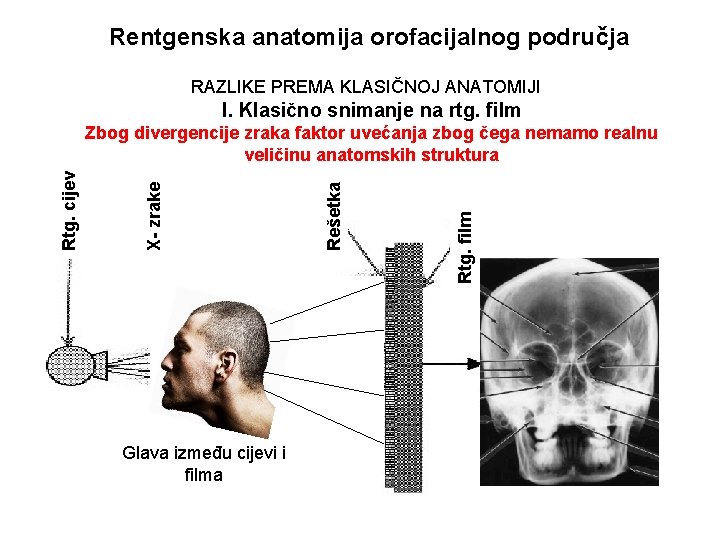 Rentgenska anatomija orofacijalnog područja RAZLIKE PREMA KLASIČNOJ ANATOMIJI I. Klasično snimanje na rtg. film