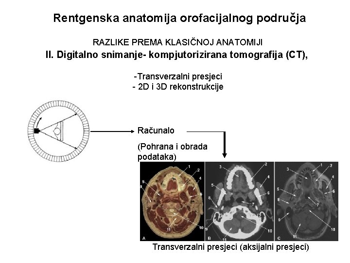 Rentgenska anatomija orofacijalnog područja RAZLIKE PREMA KLASIČNOJ ANATOMIJI II. Digitalno snimanje- kompjutorizirana tomografija (CT),