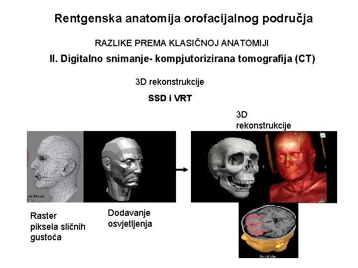 Rentgenska anatomija orofacijalnog područja RAZLIKE PREMA KLASIČNOJ ANATOMIJI II. Digitalno snimanje- kompjutorizirana tomografija (CT)