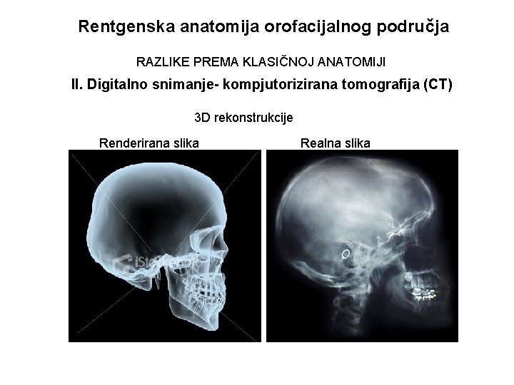 Rentgenska anatomija orofacijalnog područja RAZLIKE PREMA KLASIČNOJ ANATOMIJI II. Digitalno snimanje- kompjutorizirana tomografija (CT)