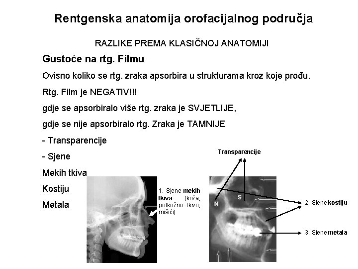 Rentgenska anatomija orofacijalnog područja RAZLIKE PREMA KLASIČNOJ ANATOMIJI Gustoće na rtg. Filmu Ovisno koliko