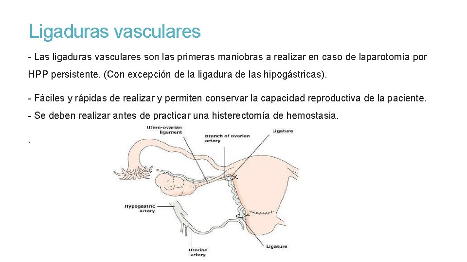 Ligaduras vasculares - Las ligaduras vasculares son las primeras maniobras a realizar en caso