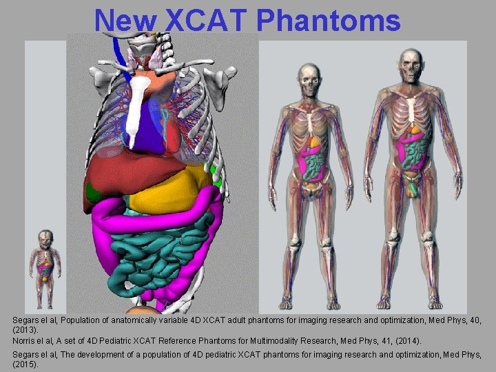 New XCAT Phantoms Segars el al, Population of anatomically variable 4 D XCAT adult