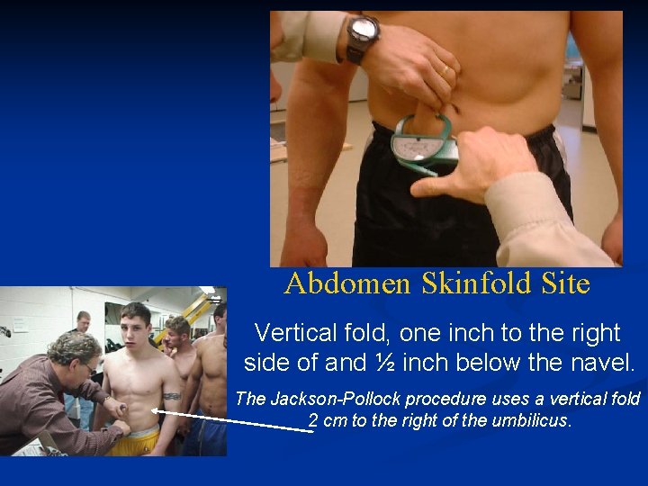 Abdomen Skinfold Site Vertical fold, one inch to the right side of and ½