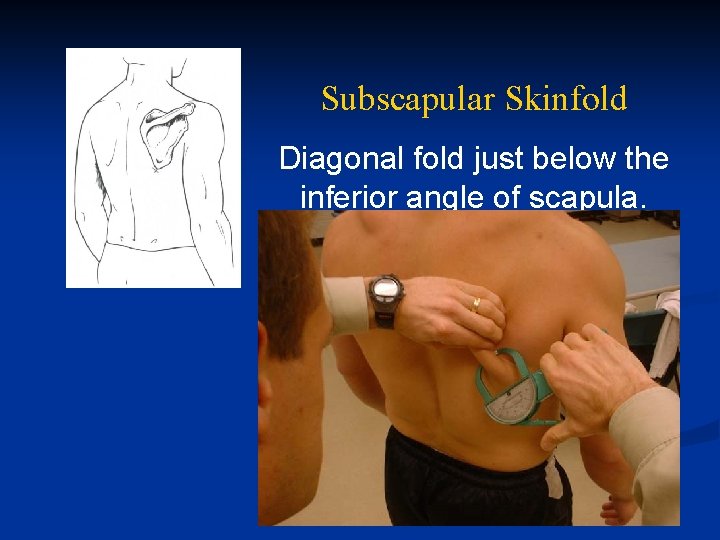 Subscapular Skinfold Diagonal fold just below the inferior angle of scapula. 