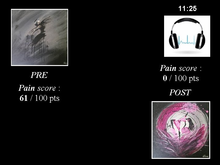 11: 25 PRE Pain score : 61 / 100 pts Pain score : 0 11: 25 PRE Pain score : 61 / 100 pts Pain score : 0
