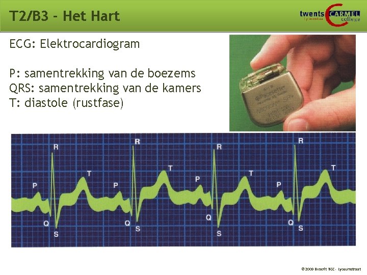 T 2/B 3 - Het Hart ECG: Elektrocardiogram P: samentrekking van de boezems QRS:
