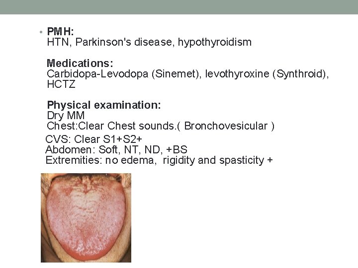 • PMH: HTN, Parkinson's disease, hypothyroidism Medications: Carbidopa-Levodopa (Sinemet), levothyroxine (Synthroid), HCTZ Physical • PMH: HTN, Parkinson's disease, hypothyroidism Medications: Carbidopa-Levodopa (Sinemet), levothyroxine (Synthroid), HCTZ Physical