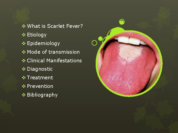 v What is Scarlet Fever? v Etiology v Epidemiology v Mode of transmission v