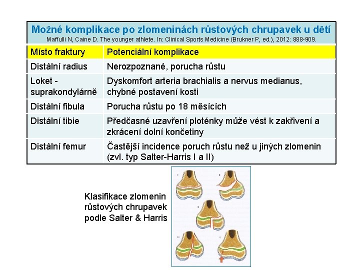 Možné komplikace po zlomeninách růstových chrupavek u dětí Maffulli N, Caine D. The younger Možné komplikace po zlomeninách růstových chrupavek u dětí Maffulli N, Caine D. The younger