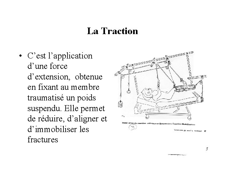 La Traction • C’est l’application d’une force d’extension, obtenue en fixant au membre traumatisé