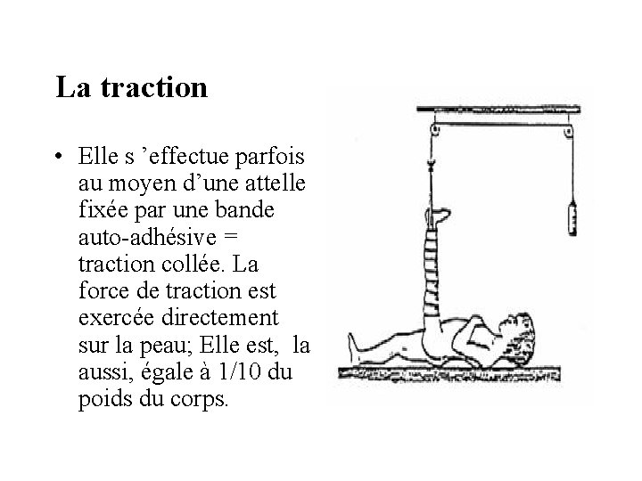 La traction • Elle s ’effectue parfois au moyen d’une attelle fixée par une