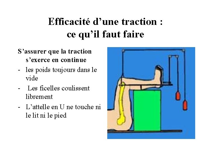 Efficacité d’une traction : ce qu’il faut faire S’assurer que la traction s’exerce en