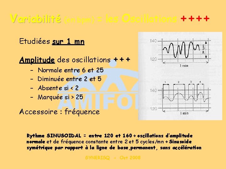 Variabilité (en bpm) = les Oscillations ++++ Etudiées sur 1 mn Amplitude des oscillations