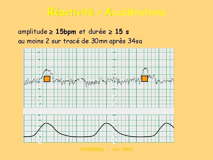 Réactivité = Accélérations amplitude 15 bpm et durée 15 s au moins 2 sur