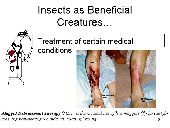 Insects as Beneficial Creatures… • Treatment of certain medical conditions Maggot Debridement Therapy (MDT)