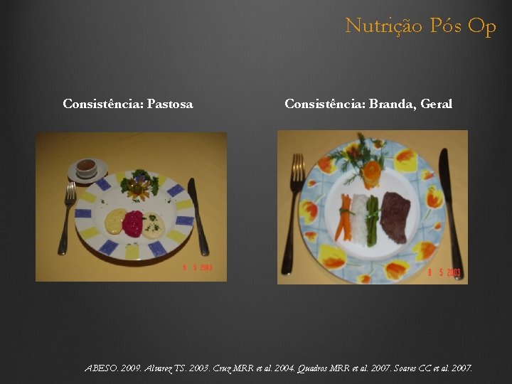 Nutrição Pós Op Consistência: Pastosa Consistência: Branda, Geral ABESO. 2009. Alvarez TS. 2003. Cruz