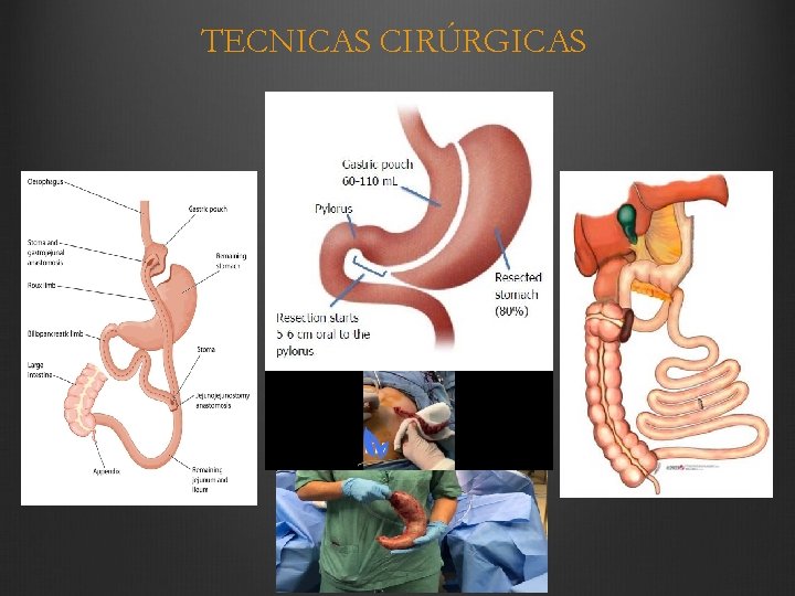 TECNICAS CIRÚRGICAS 