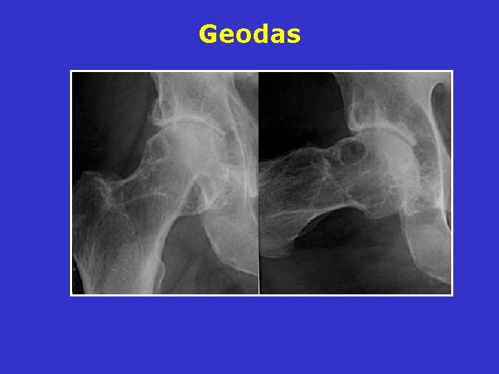 Geodas Geodas