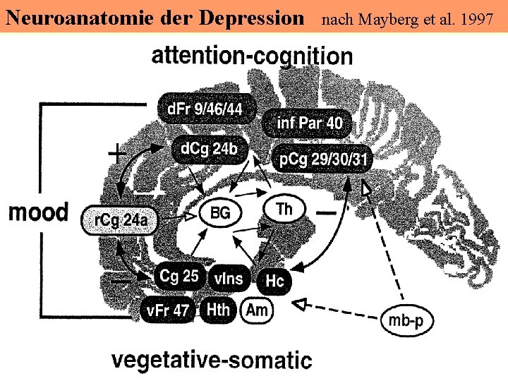 Neuroanatomie der Depression nach Mayberg et al. 1997 Neuroanatomie der Depression nach Mayberg et al. 1997