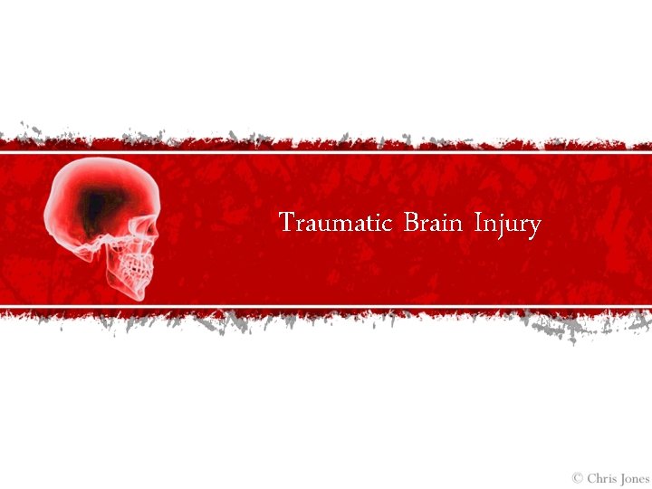 Traumatic Brain Injury 