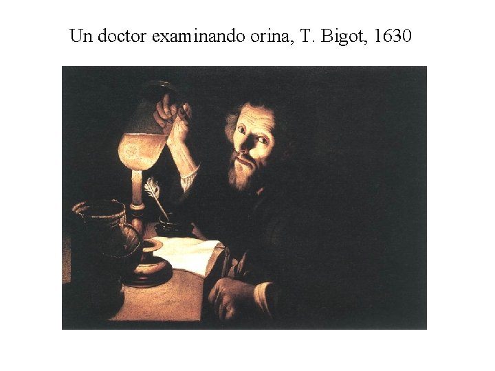 Un doctor examinando orina, T. Bigot, 1630 
