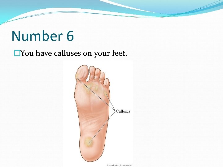 Number 6 �You have calluses on your feet. 