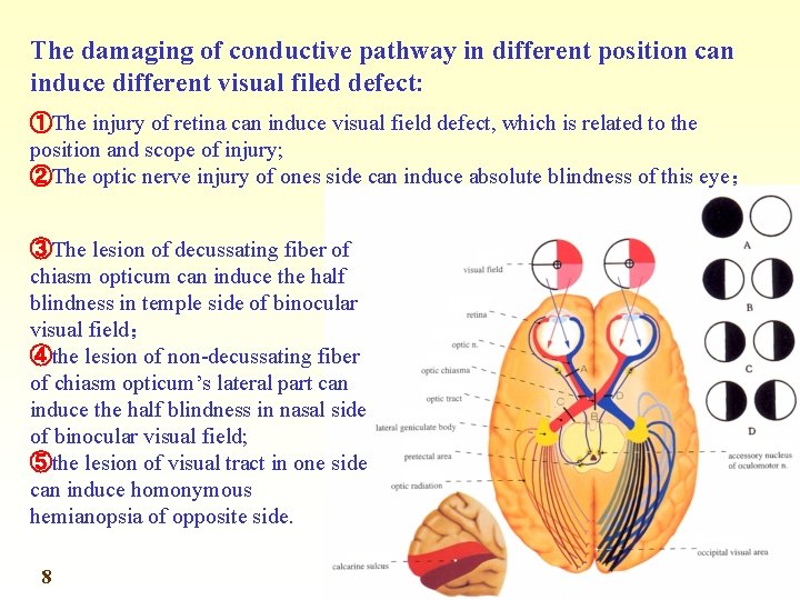 The damaging of conductive pathway in different position can induce different visual filed defect: