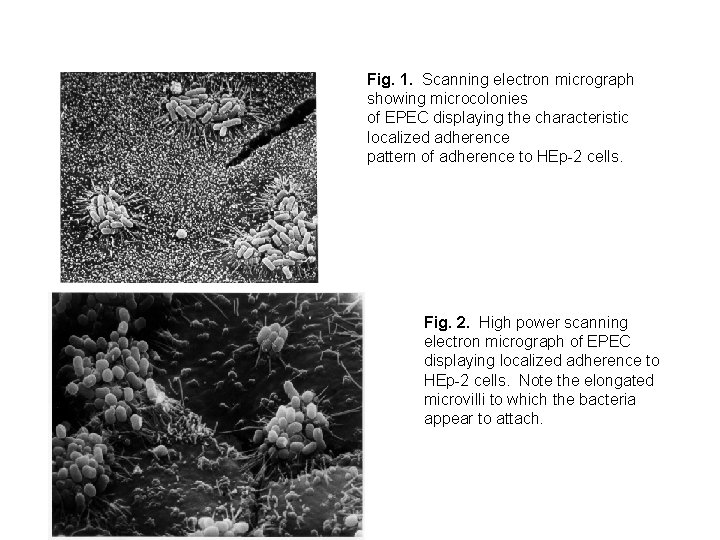 Fig. 1. Scanning electron micrograph showing microcolonies of EPEC displaying the characteristic localized adherence