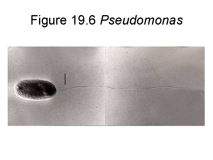 Figure 19. 6 Pseudomonas 