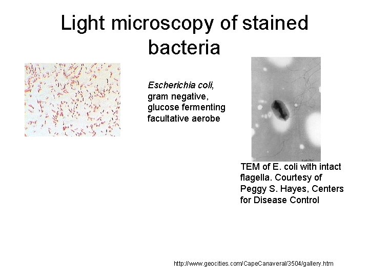 Light microscopy of stained bacteria Escherichia coli, gram negative, glucose fermenting facultative aerobe TEM