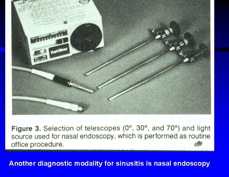 Another diagnostic modality for sinusitis is nasal endoscopy 