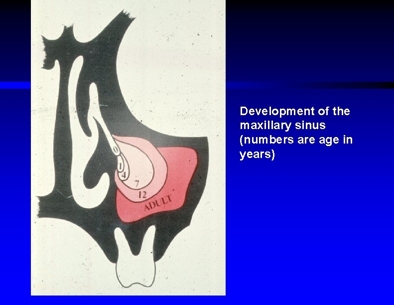 Development of the maxillary sinus (numbers are age in years) 