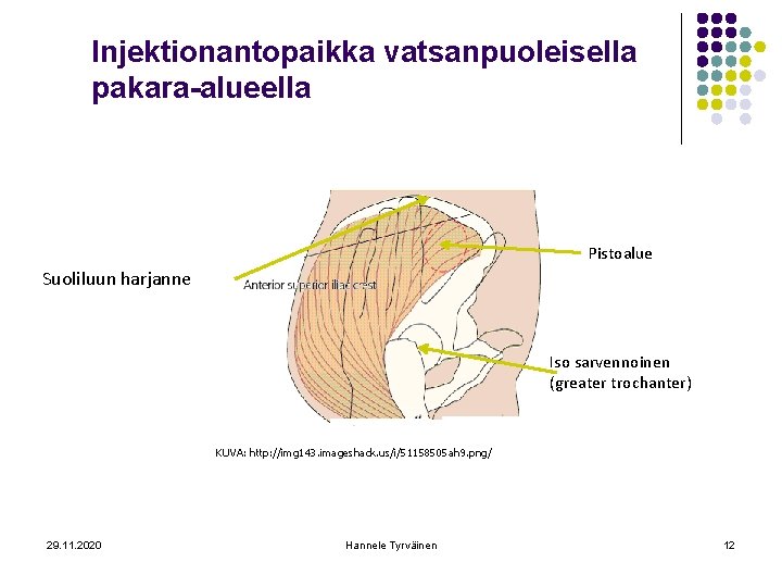 Injektionantopaikka vatsanpuoleisella pakara-alueella Pistoalue Suoliluun harjanne Iso sarvennoinen (greater trochanter) KUVA: http: //img 143.